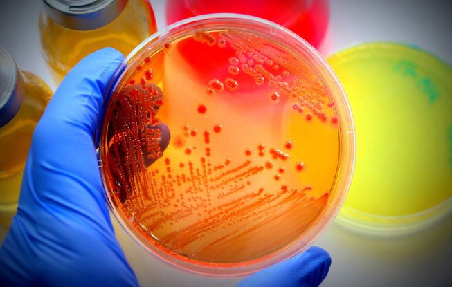 Hand with glove holding a petri dish with e coli.