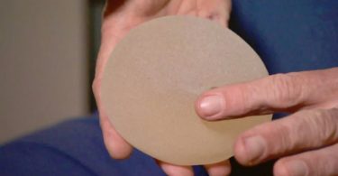 On May 28, Health Canada said it has suspended the licences of Ireland-based Allergan for its Biocell implants, after finding 'significantly higher' rates of a type of non-Hodgkin lymphoma among patients with macro-textured breast implants. (Nicholas Amaya/CBC)