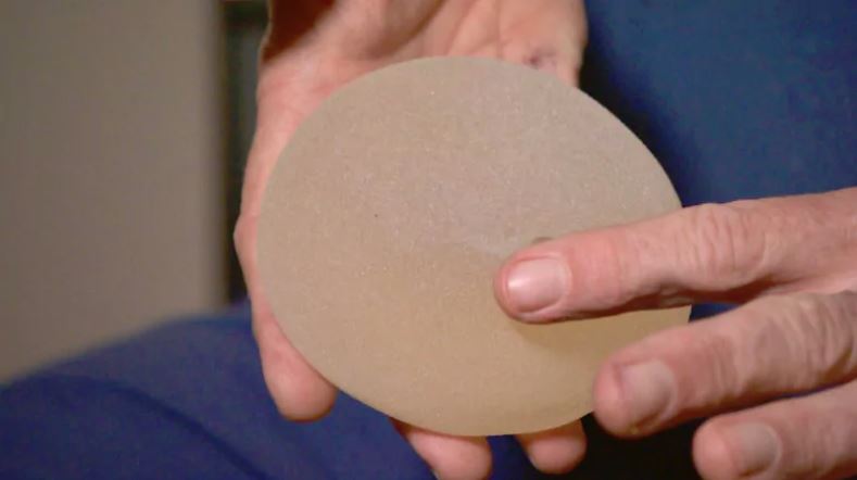 On May 28, Health Canada said it has suspended the licences of Ireland-based Allergan for its Biocell implants, after finding 'significantly higher' rates of a type of non-Hodgkin lymphoma among patients with macro-textured breast implants. (Nicholas Amaya/CBC)