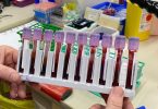 Blood samples ready for analysis in the laboratory.