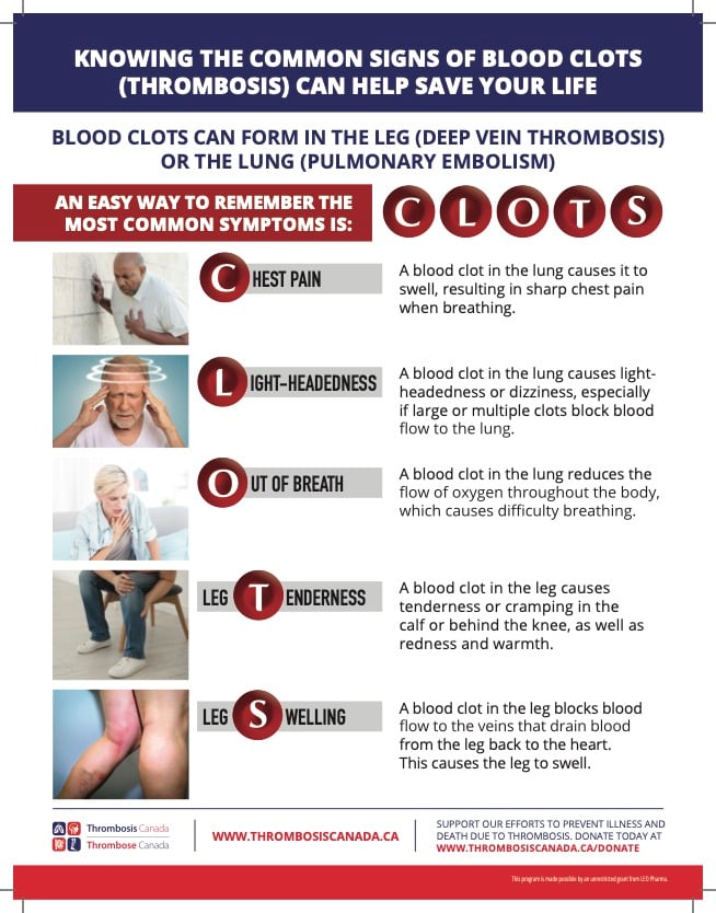 Cancer and clot risk explained after Catherine O'Hara's death - The ...